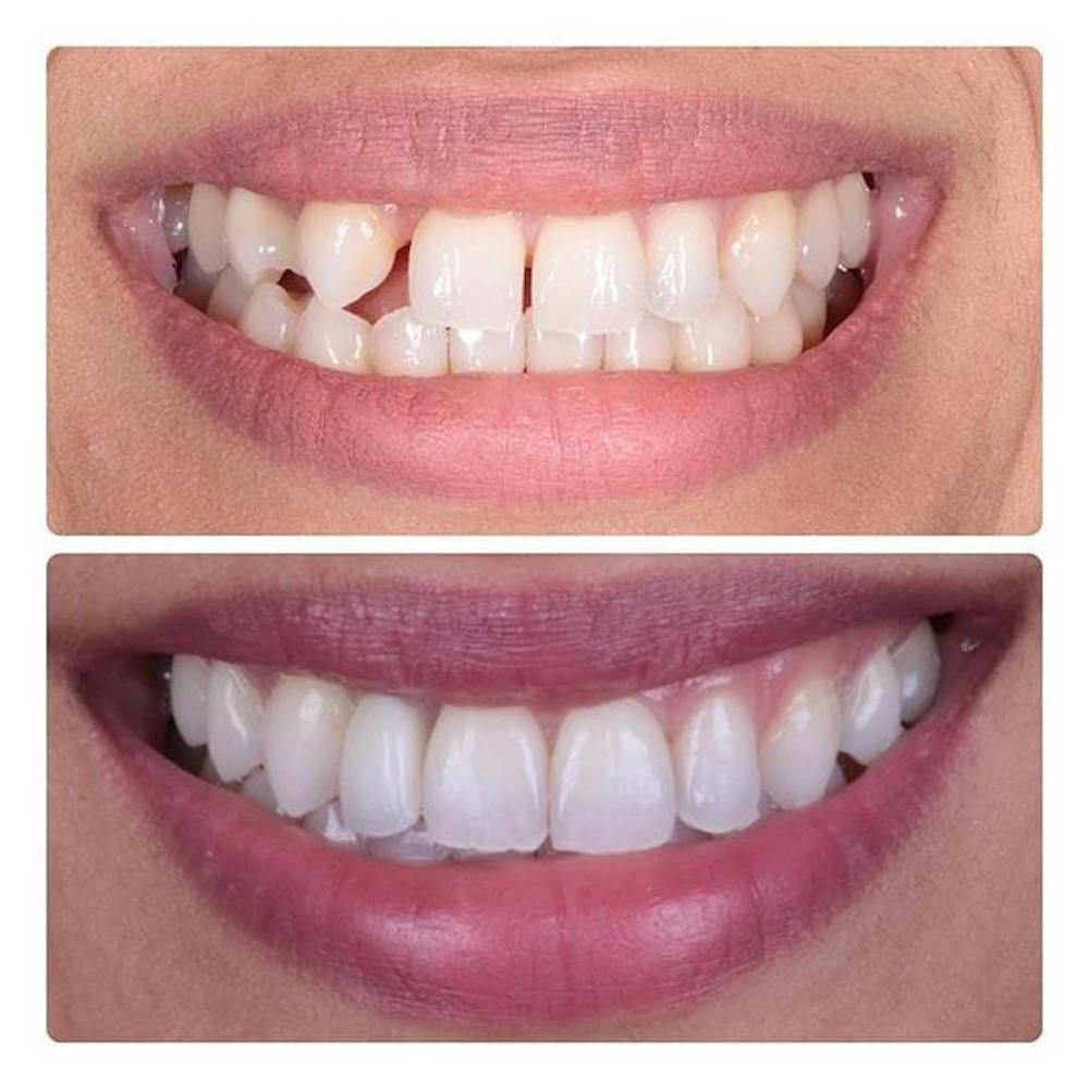 Gallery Before & After Gallery - Patient 4387412 - Image 1
