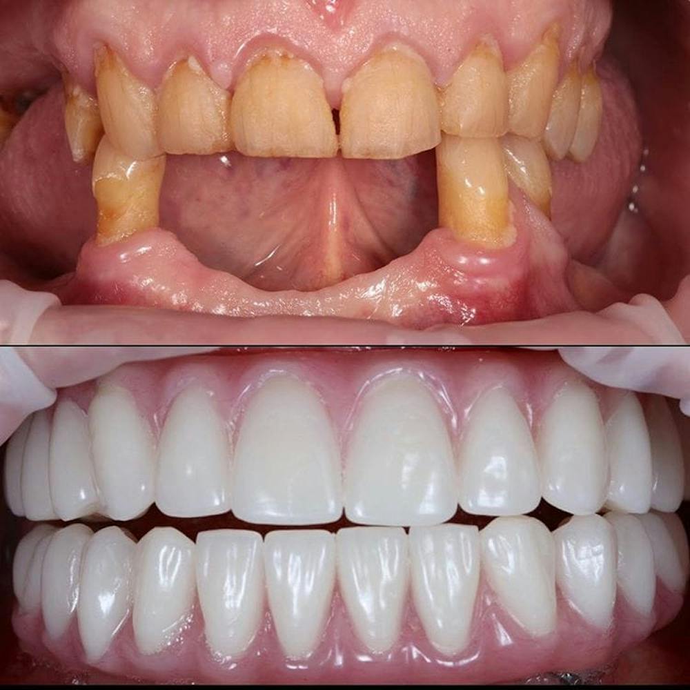 Gallery Before & After Gallery - Patient 4387413 - Image 1