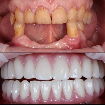 Gallery Before & After Gallery - Patient 4387413 - Image 1