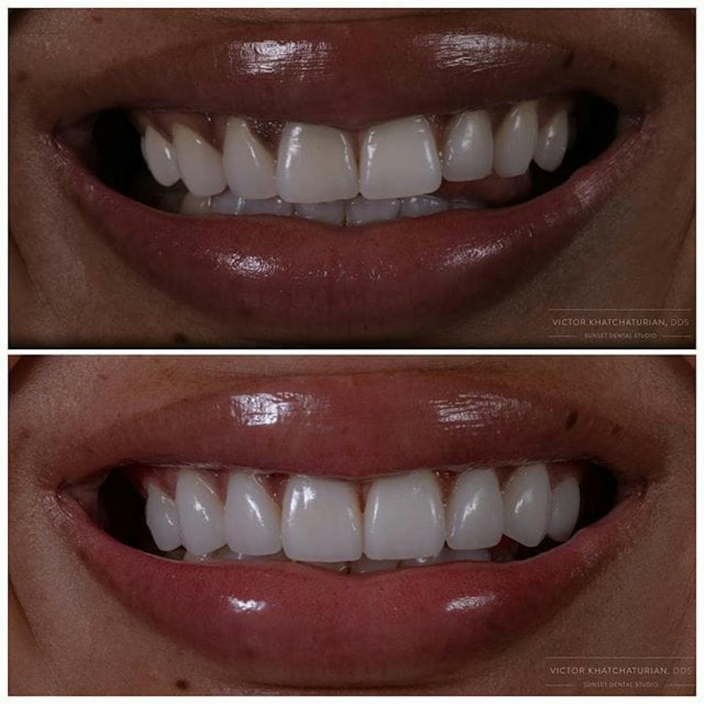 Gallery Before & After Gallery - Patient 4387416 - Image 1