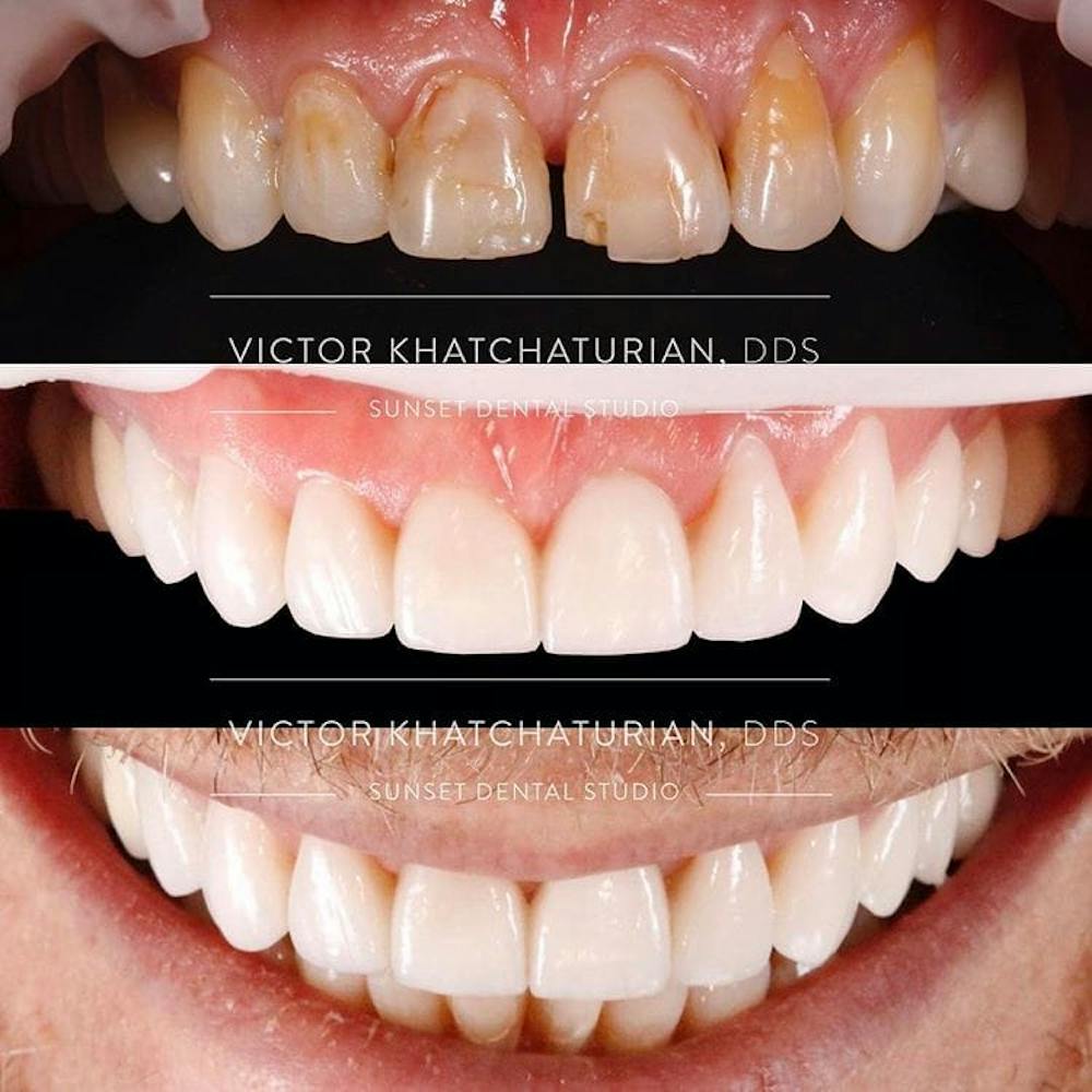 Gallery Before & After Gallery - Patient 4387425 - Image 1
