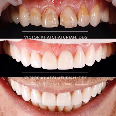 Gallery Before & After Gallery - Patient 4387425 - Image 1