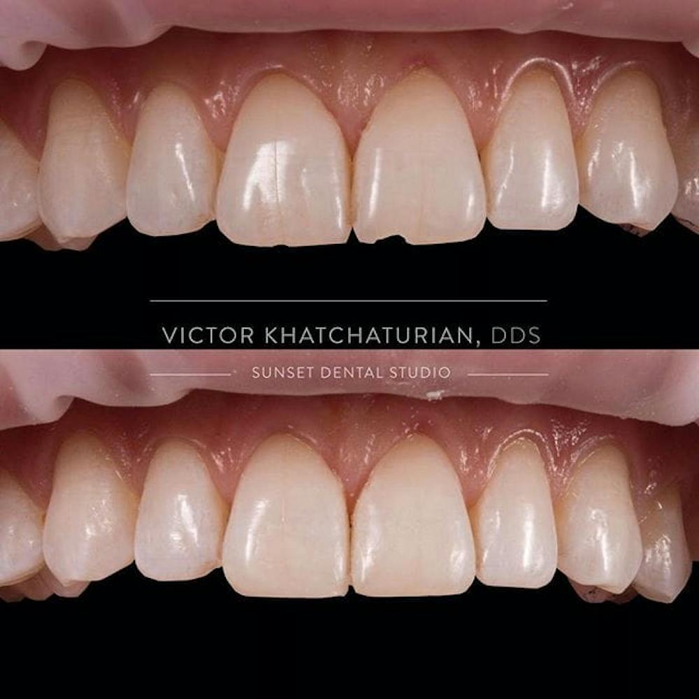 Gallery Before & After Gallery - Patient 4387427 - Image 1