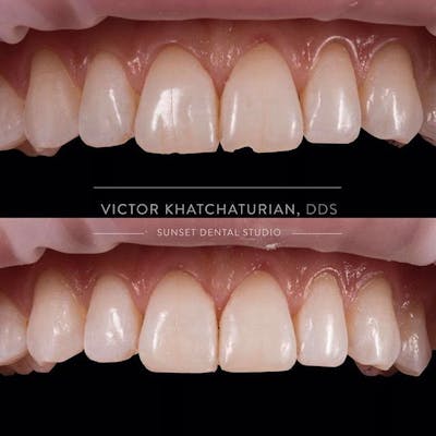 Gallery Before & After Gallery - Patient 4387427 - Image 1