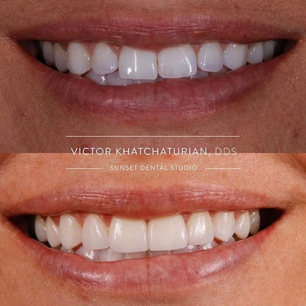 Gallery Before & After Gallery - Patient 4387428 - Image 1