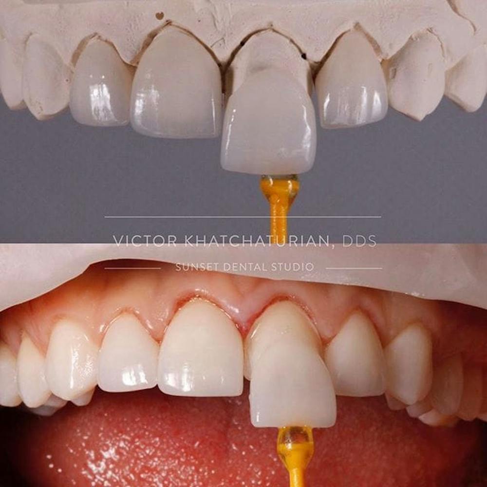 Gallery Before & After Gallery - Patient 4387429 - Image 1
