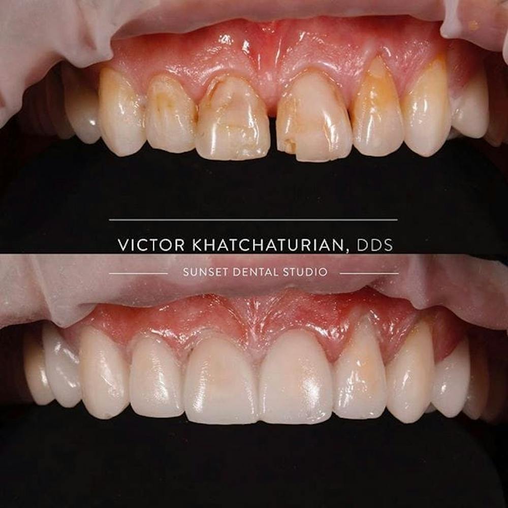 Gallery Before & After Gallery - Patient 4387430 - Image 1