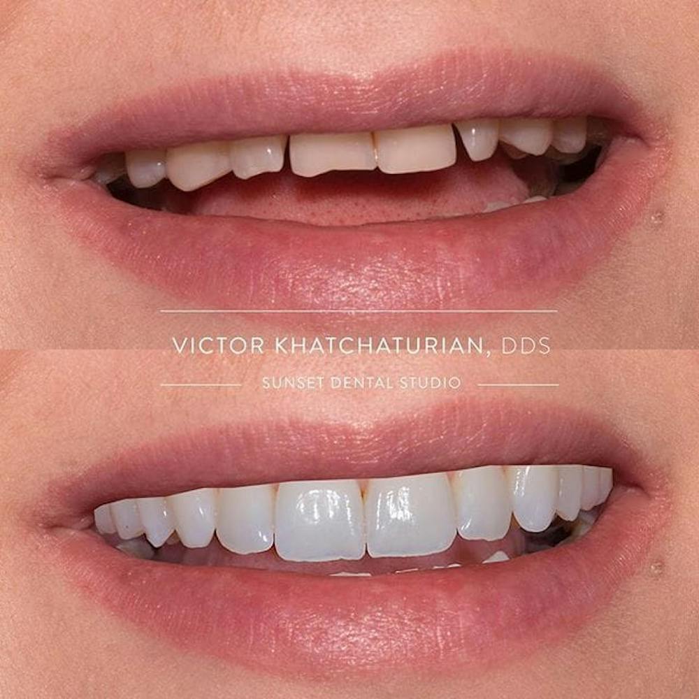 Gallery Before & After Gallery - Patient 4387431 - Image 1