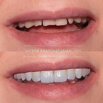 Gallery Before & After Gallery - Patient 4387431 - Image 1