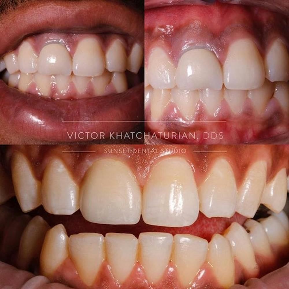 Gallery Before & After Gallery - Patient 4387432 - Image 1