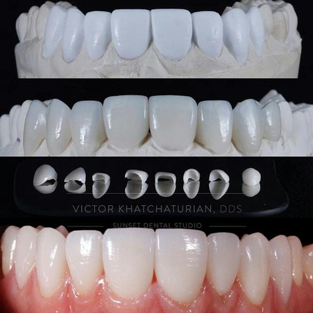 Gallery Before & After Gallery - Patient 4387433 - Image 1