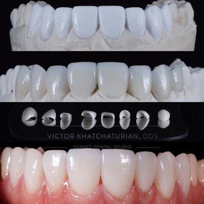 Gallery Before & After Gallery - Patient 4387433 - Image 1