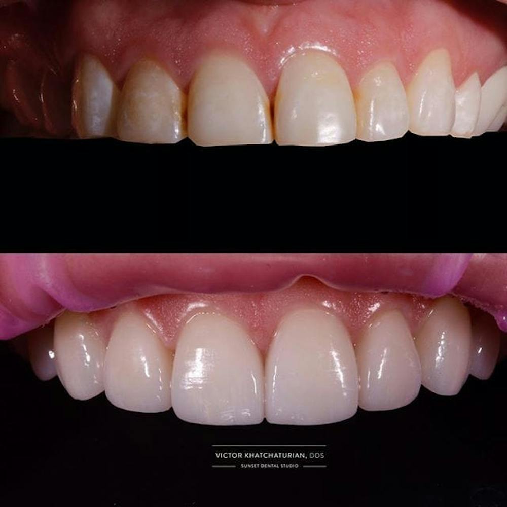 Gallery Before & After Gallery - Patient 4387434 - Image 1