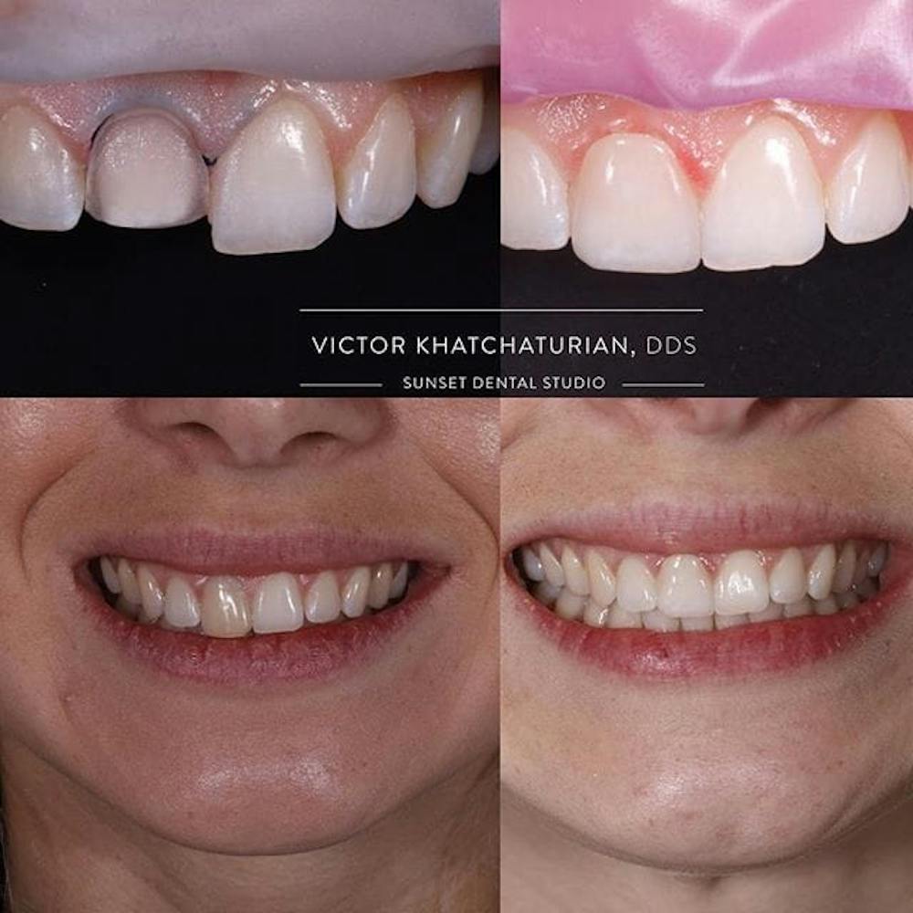 Gallery Before & After Gallery - Patient 4387435 - Image 1