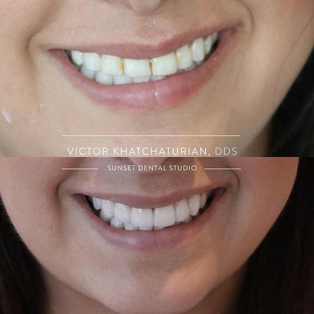 Gallery Before & After Gallery - Patient 4387436 - Image 1