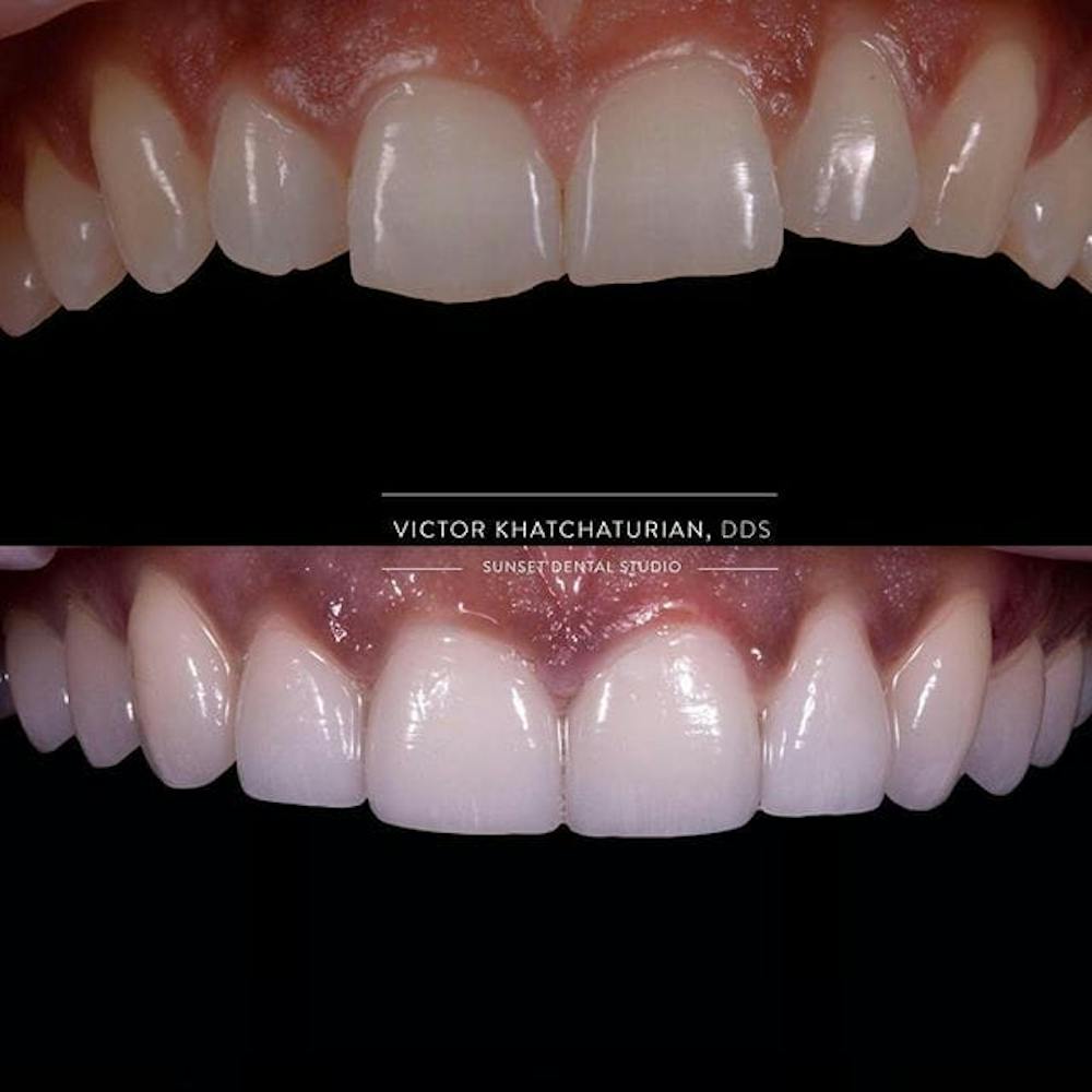 Gallery Before & After Gallery - Patient 4387437 - Image 1