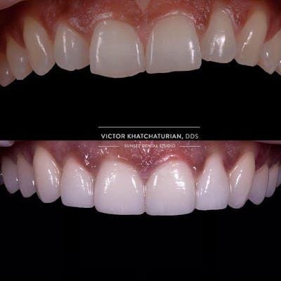 Gallery Before & After Gallery - Patient 4387437 - Image 1