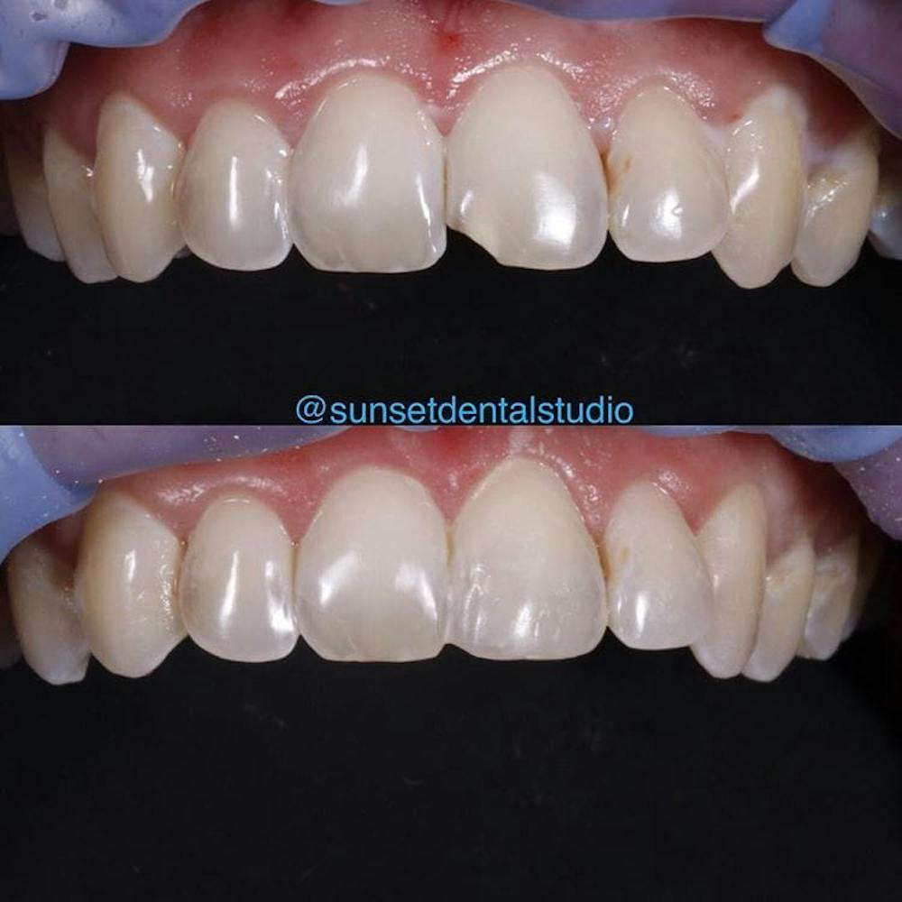 Gallery Before & After Gallery - Patient 4387438 - Image 1