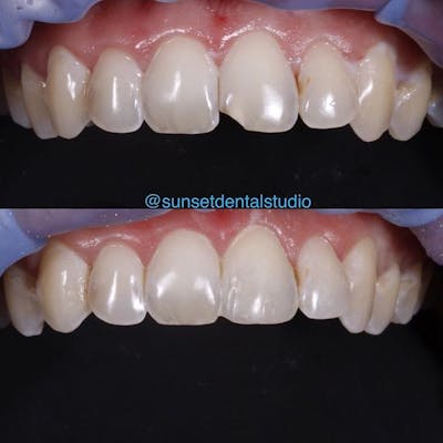 Gallery Before & After Gallery - Patient 4387438 - Image 1
