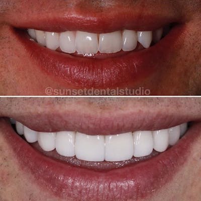 Gallery Before & After Gallery - Patient 4387439 - Image 1
