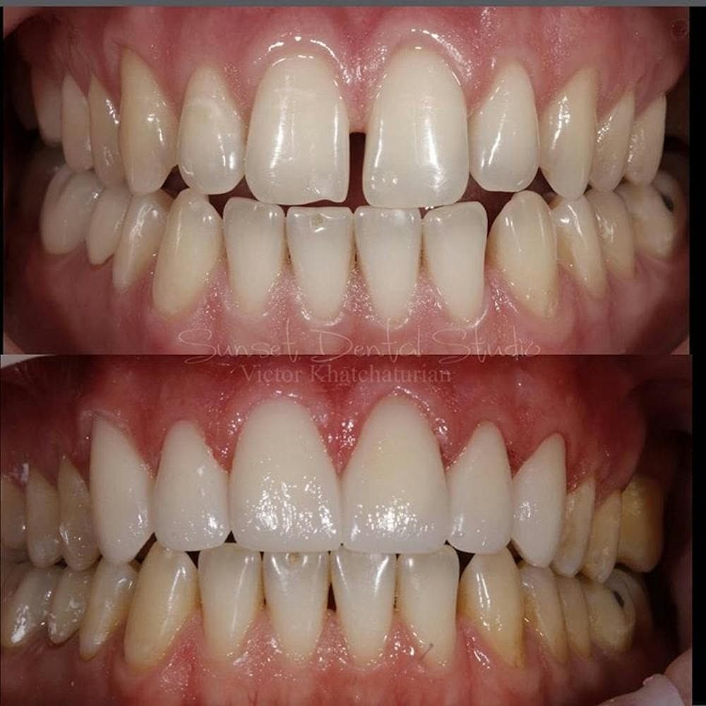 Gallery Before & After Gallery - Patient 4387440 - Image 1