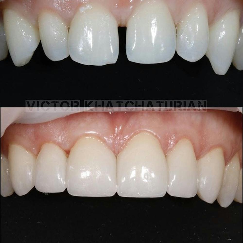 Gallery Before & After Gallery - Patient 4387441 - Image 1