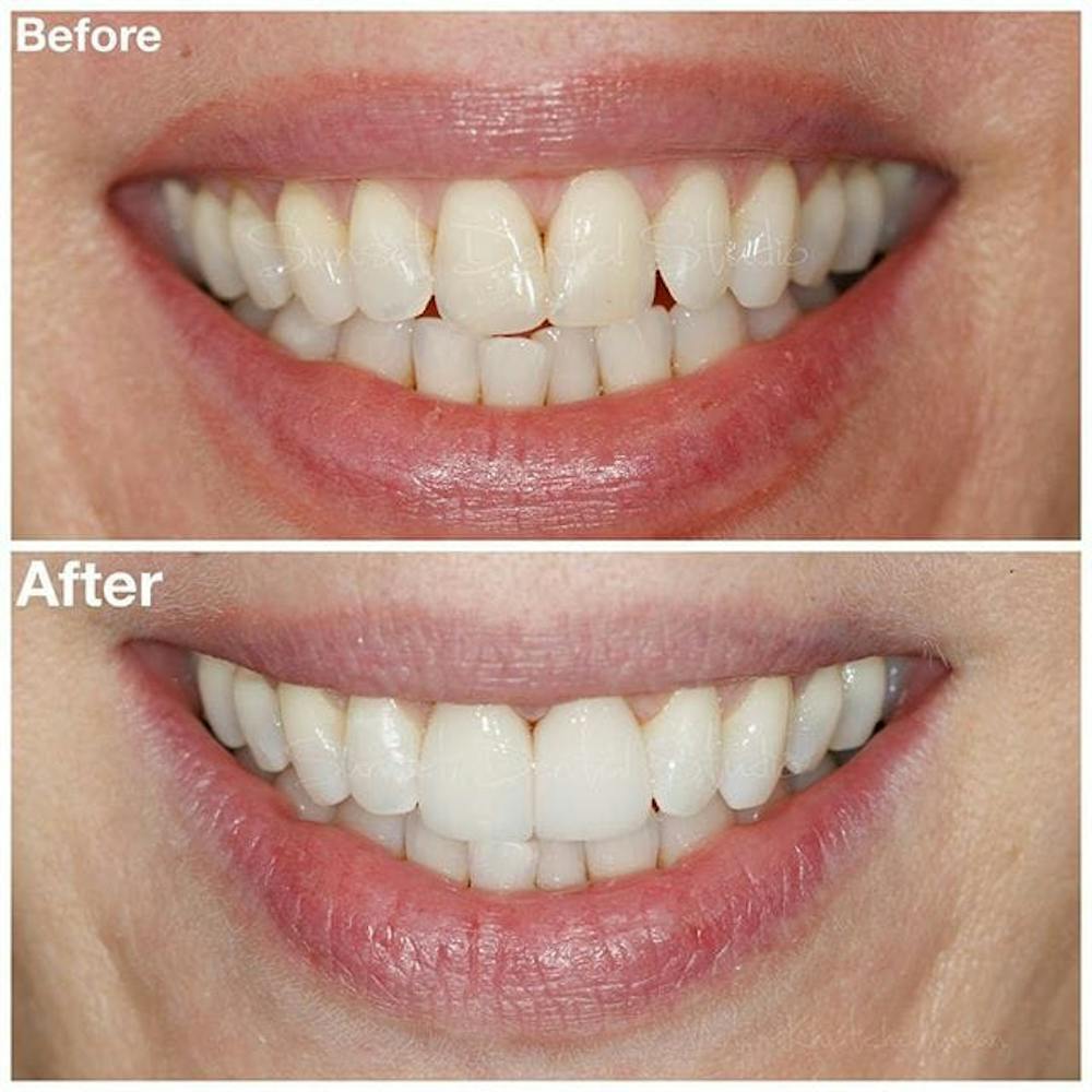 Gallery Before & After Gallery - Patient 4387443 - Image 1
