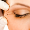 Cynthia M. Poulos MD Blog | Incredible Injectables! Subtle and instant facial rejuvenation