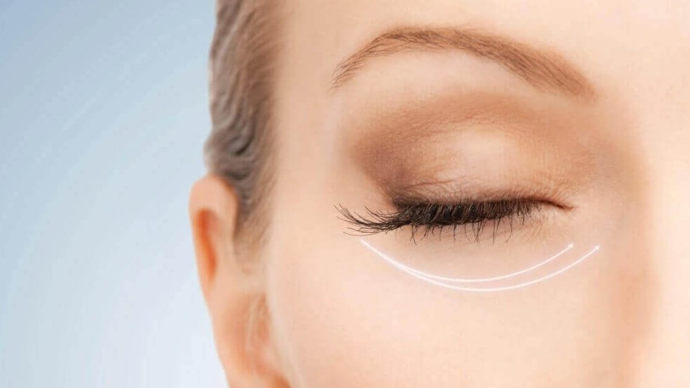 The Facts About Facelifts