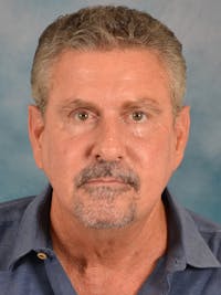 Laser Skin Resurfacing Before & After Gallery - Patient 207688 - Image 1