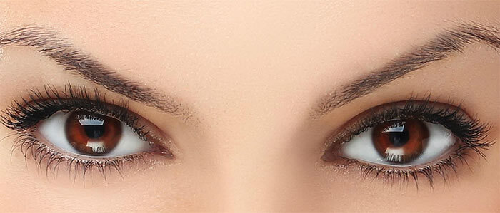 Blepharoplasty