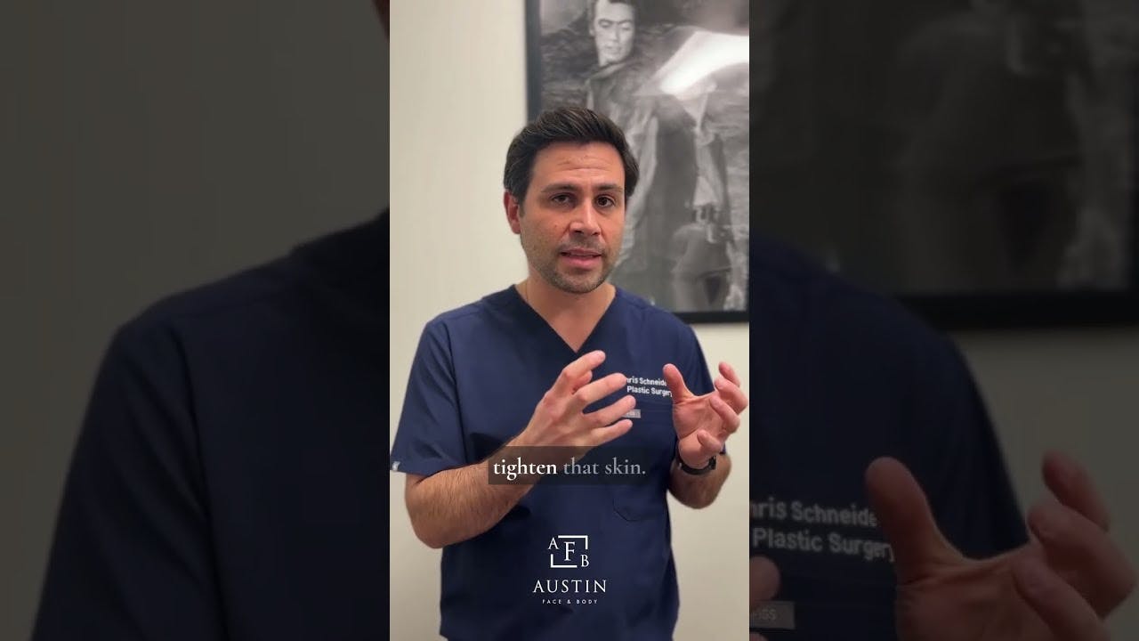 doctor speaking about liposuction vs bodytite
