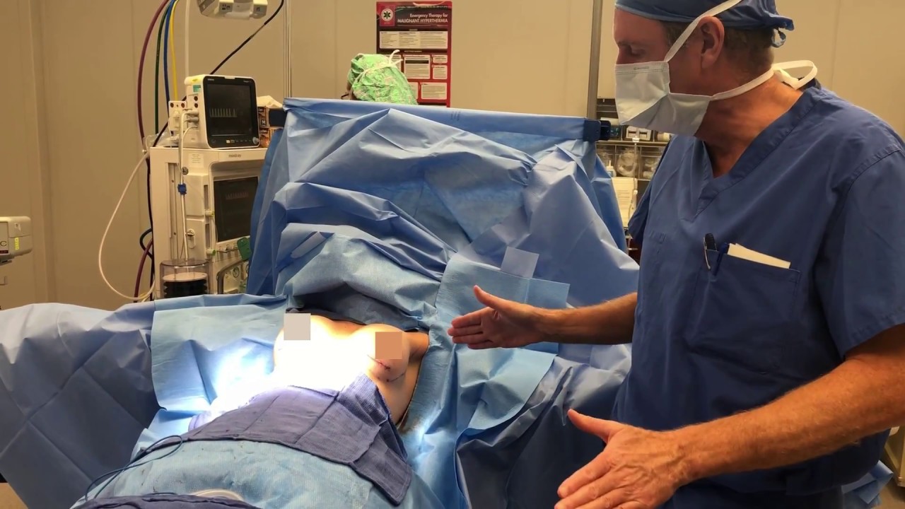 breast augmentation surgery