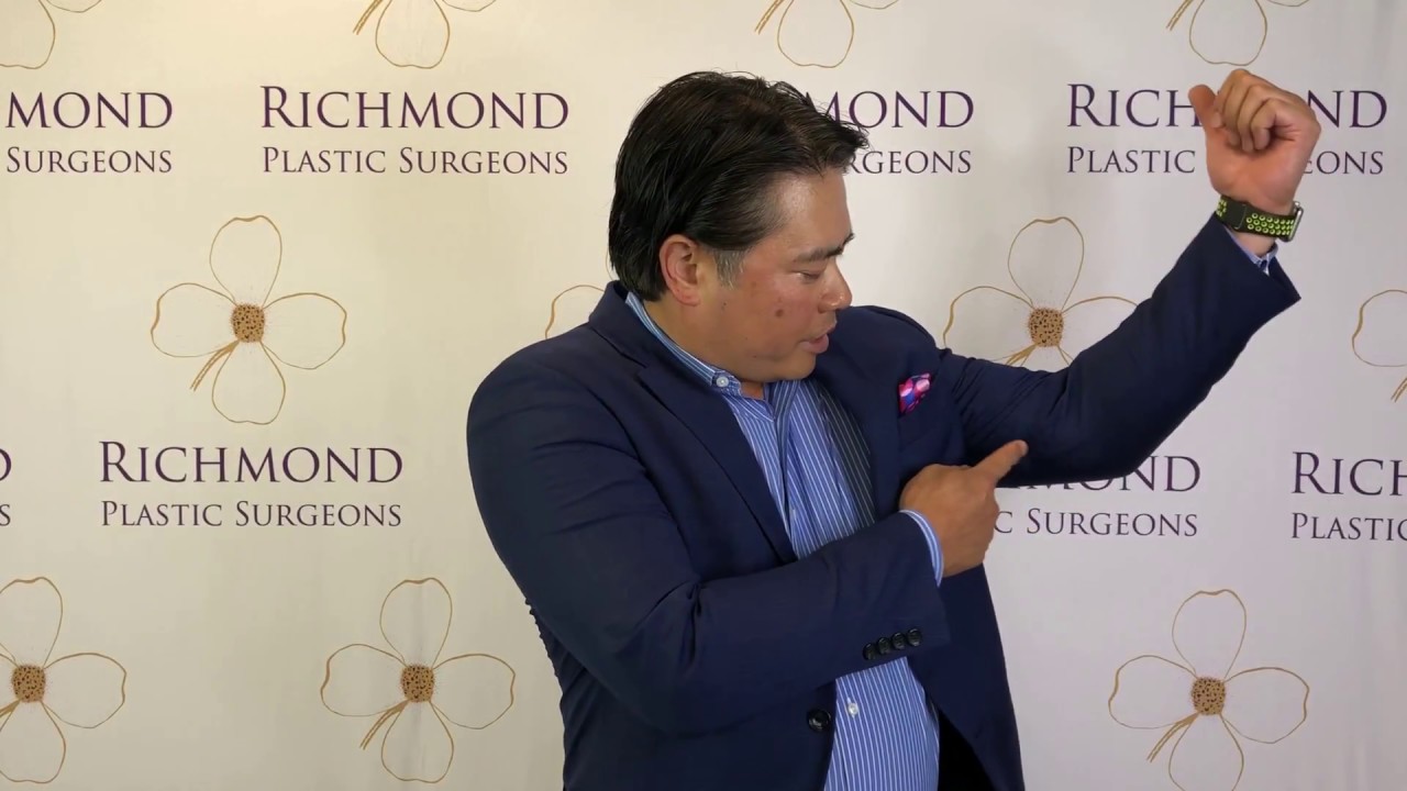 Doctor pointing to his arms