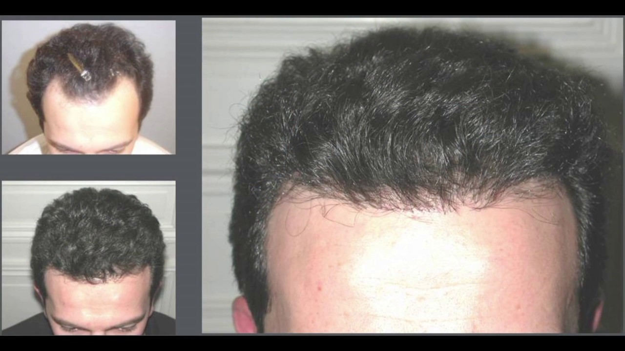 before and after hair photo