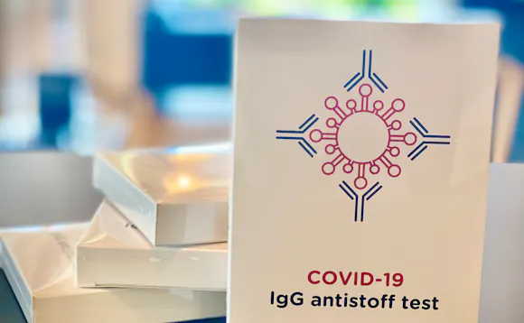 Koronatest utviklet av Vitas