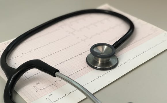Hjerteflimmer diagnostiseres på EKG Hjerteflimmer diagnostiseres på EKG