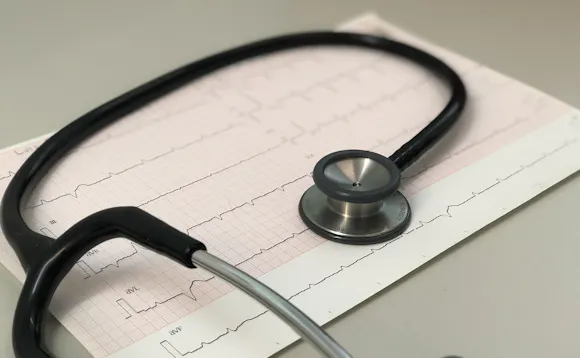 Hjerteflimmer diagnostiseres på EKG Hjerteflimmer diagnostiseres på EKG