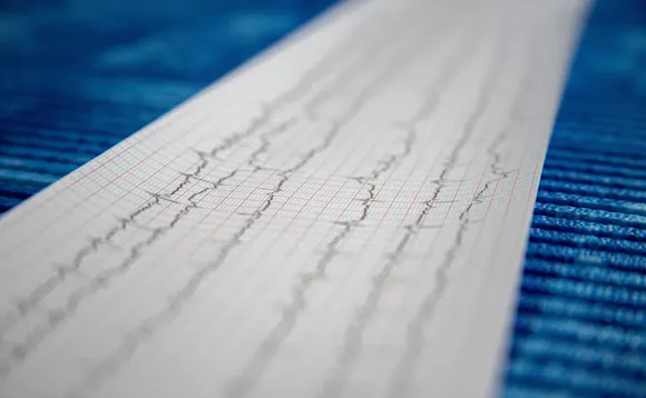 Hjertestans Hjertestans