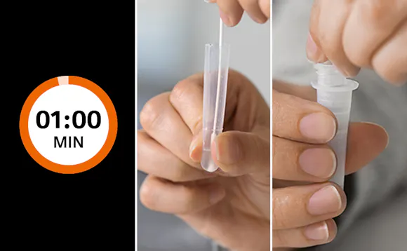 La stå og sett inn dråpetellerspissen