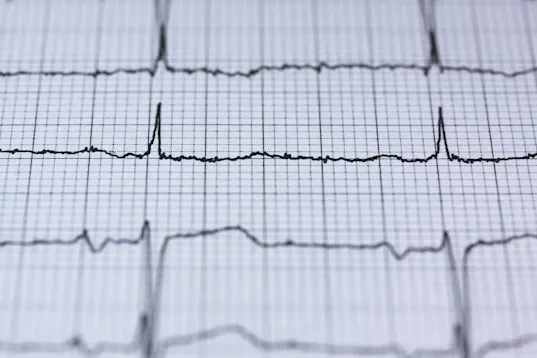 EKG - hjerteregistrering