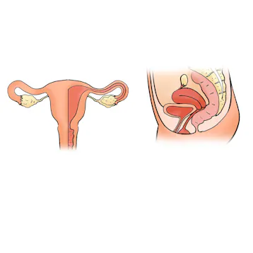 Uterus og ovarier
