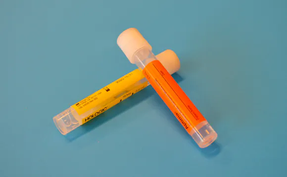 Prøveglass for kjønnssykdommer Prøveglass for kjønnssykdommer