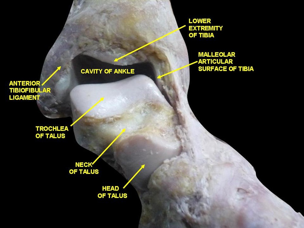 Ankle (Talocrural, Subtalar, and Tibiofibular) Joint