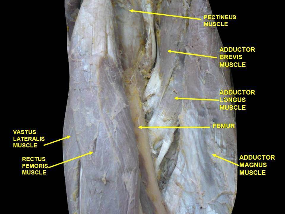 Multifidus Muscle Cadaver