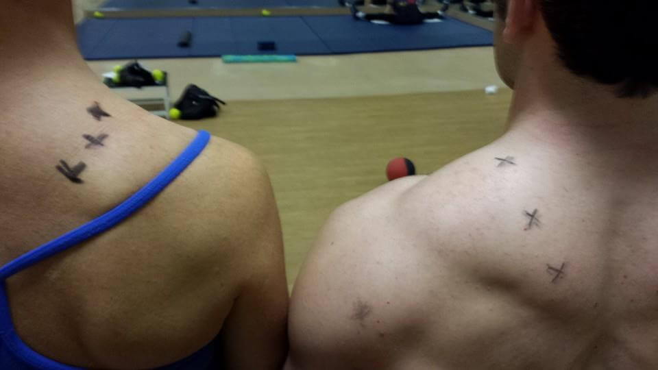 Trigger Point