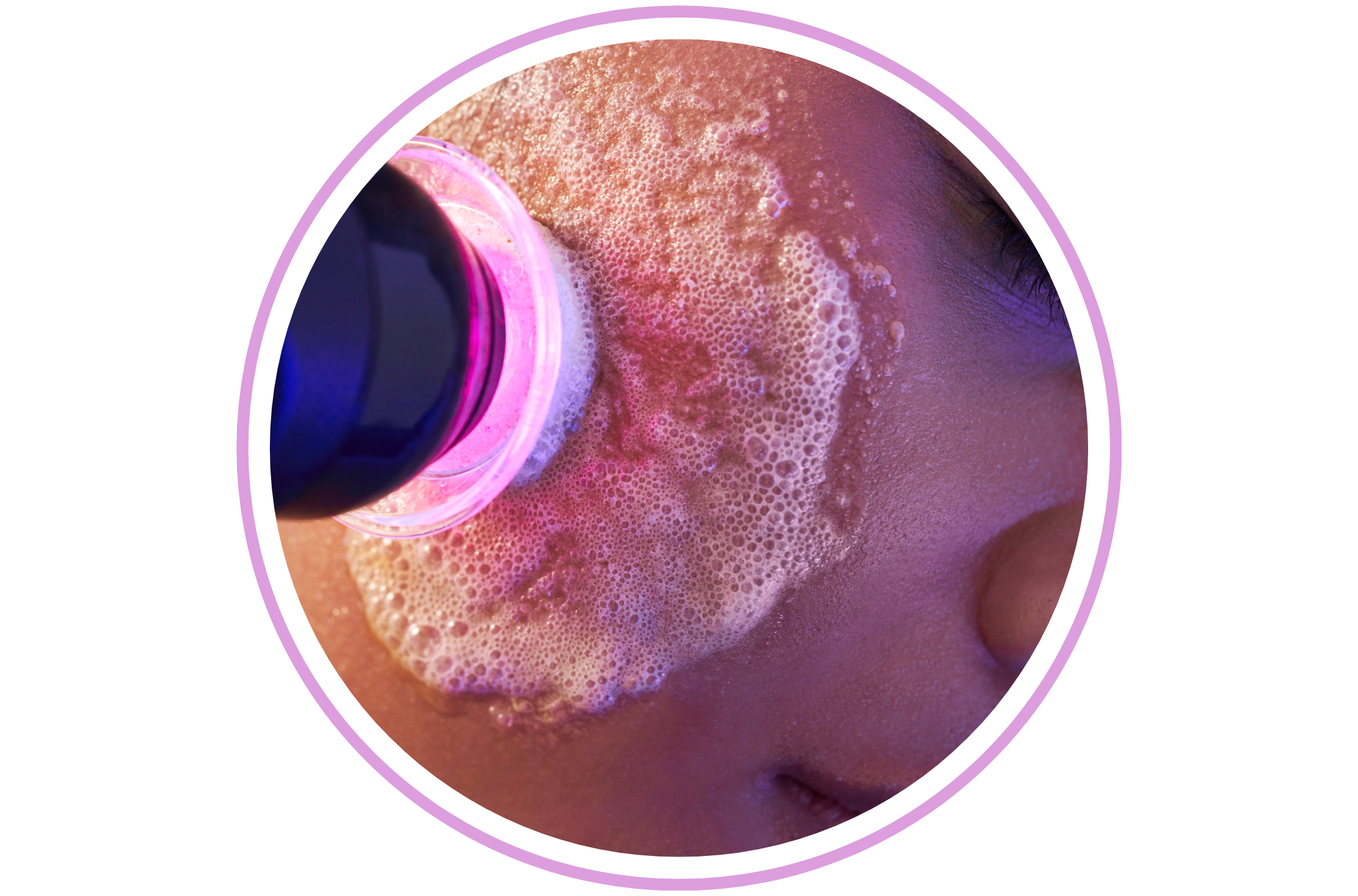 Up close image of a Glo2Facial