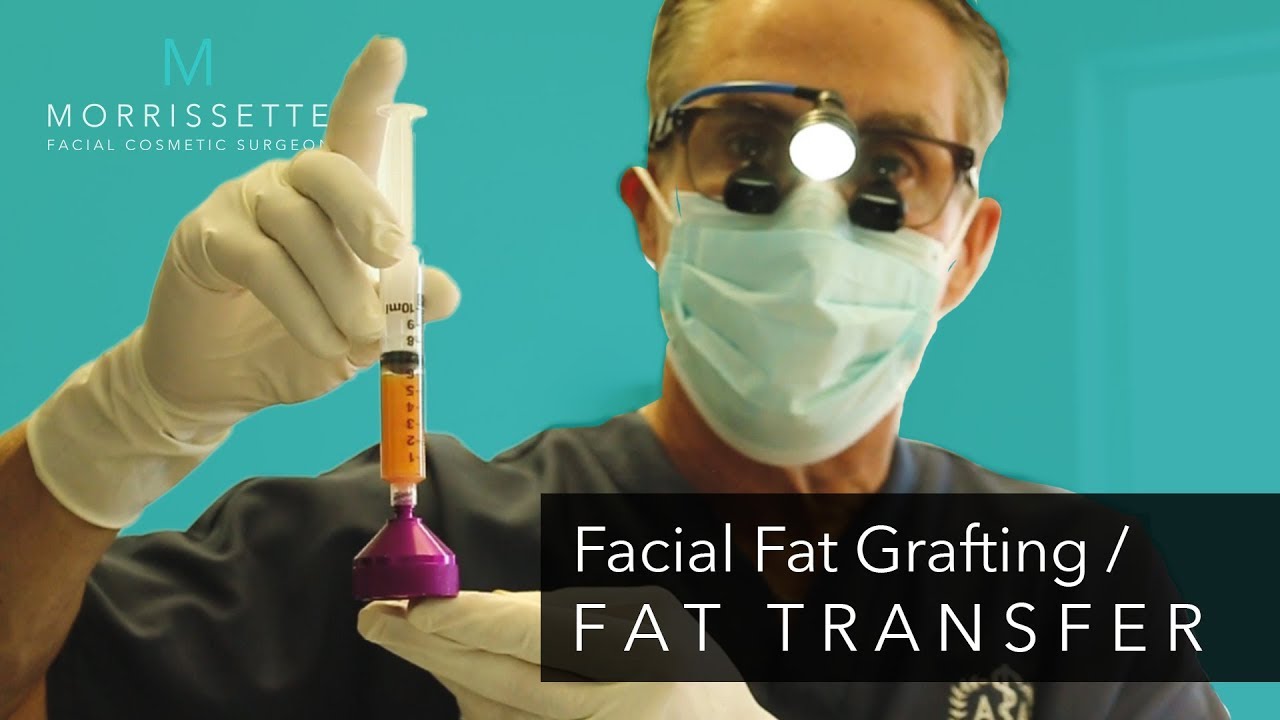 Facial Fat Grafting Ventura