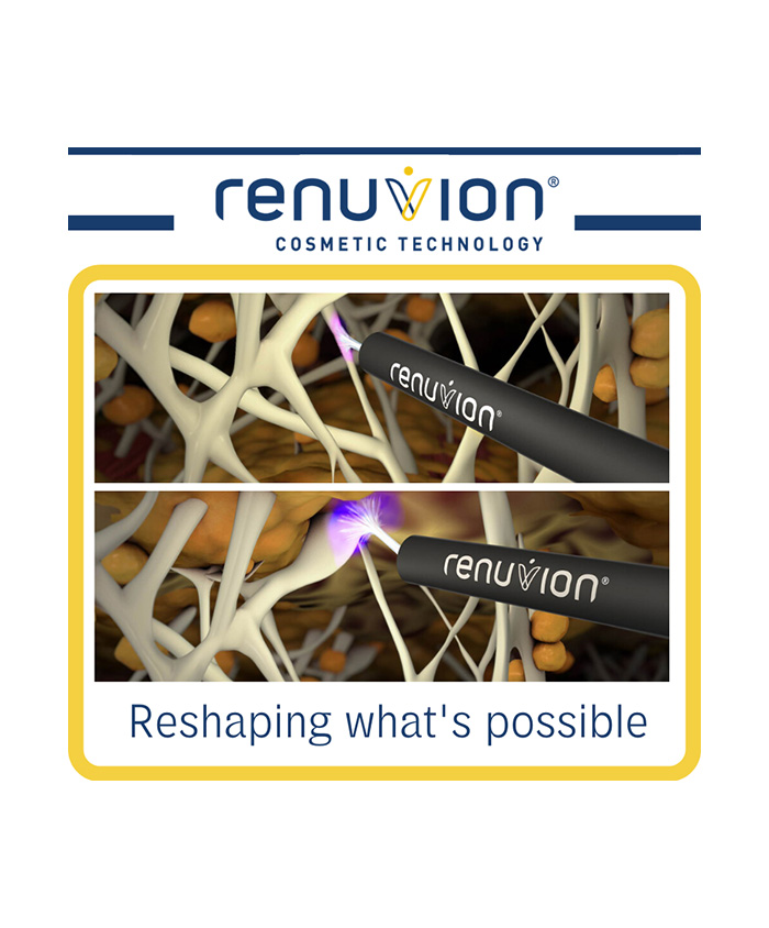 renuvion handpiece