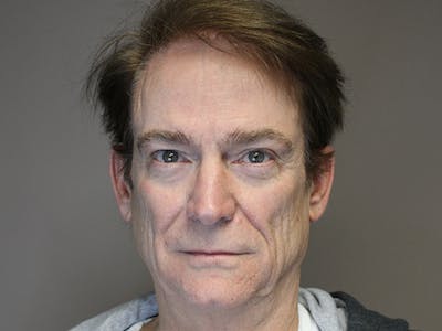 Facial Rejuvenation Before & After Gallery - Patient 110647769 - Image 1